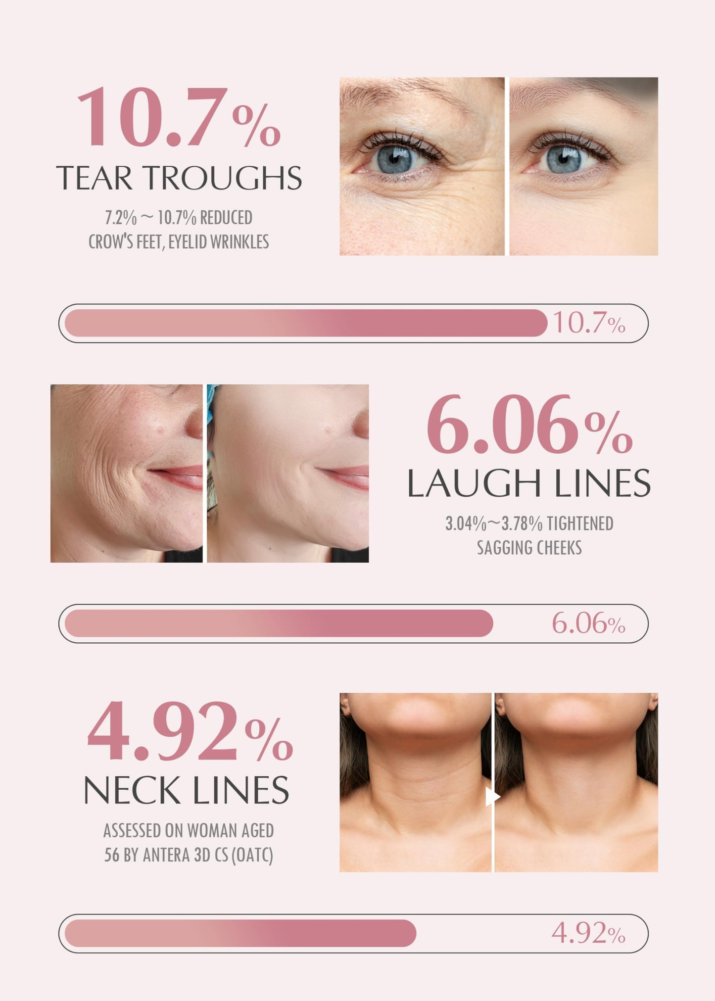 KAHI Wrinkle Bounce Multi Balm Stick - PDRN Collagen Facial & Body Balm | PDRN + Collagen, 48-Hour Hydration, Multi-Purpose Balm, Face Care, Eye Care, Lip Care, Neck Care, Makeup Base, Portable Stick